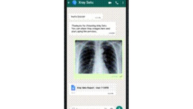 AI-driven ‘XraySetu’ to facilitate early COVID interventions